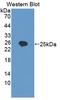 Myosin Light Chain Kinase 2 antibody, LS-C694765, Lifespan Biosciences, Western Blot image 