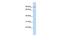 TCDD-inducible poly [ADP-ribose] polymerase antibody, GTX47758, GeneTex, Western Blot image 