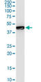 General Transcription Factor IIE Subunit 1 antibody, LS-C197377, Lifespan Biosciences, Western Blot image 