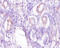 Phosphoenolpyruvate carboxylase antibody, A52968-100, Epigentek, Immunohistochemistry paraffin image 