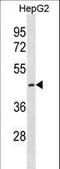 Cystinosin, Lysosomal Cystine Transporter antibody, LS-C157668, Lifespan Biosciences, Western Blot image 