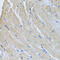 Sorcin antibody, 22-460, ProSci, Immunohistochemistry paraffin image 