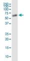 Aladin WD Repeat Nucleoporin antibody, H00008086-M02, Novus Biologicals, Western Blot image 