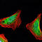 Ataxin 1 antibody, LS-C813986, Lifespan Biosciences, Immunohistochemistry paraffin image 