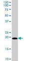 Mitochondrial Ribosomal Protein L18 antibody, H00029074-B01P, Novus Biologicals, Western Blot image 