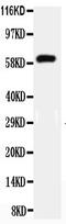 HNF1 Homeobox B antibody, LS-C313360, Lifespan Biosciences, Western Blot image 