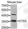 Cathepsin S antibody, A1874, ABclonal Technology, Western Blot image 