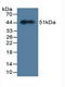 Myosin Light Chain 3 antibody, LS-C694763, Lifespan Biosciences, Western Blot image 