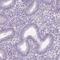 OTU Deubiquitinase 6A antibody, HPA053304, Atlas Antibodies, Immunohistochemistry paraffin image 