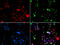 Protein Inhibitor Of Activated STAT 1 antibody, STJ28296, St John