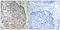 Mitochondrial Ribosome Recycling Factor antibody, LS-C120342, Lifespan Biosciences, Immunohistochemistry paraffin image 