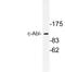 ABL Proto-Oncogene 1, Non-Receptor Tyrosine Kinase antibody, LS-C177643, Lifespan Biosciences, Western Blot image 