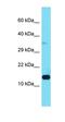 Late Endosomal/Lysosomal Adaptor, MAPK And MTOR Activator 3 antibody, orb326336, Biorbyt, Western Blot image 