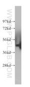 Melanoma-associated antigen 1 antibody, 12233-1-AP, Proteintech Group, Western Blot image 