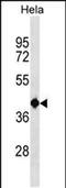 TRNA Splicing Endonuclease Subunit 2 antibody, PA5-49147, Invitrogen Antibodies, Western Blot image 
