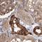 Tumor Protein D52 antibody, NBP1-85327, Novus Biologicals, Immunohistochemistry paraffin image 