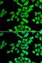 N-Myristoyltransferase 2 antibody, LS-C346201, Lifespan Biosciences, Immunofluorescence image 