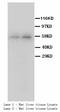 Cytochrome P450 Family 2 Subfamily E Member 1 antibody, LS-C171891, Lifespan Biosciences, Western Blot image 