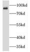 Transmembrane And Coiled-Coil Domain Family 2 antibody, FNab08736, FineTest, Western Blot image 