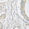 SH3 Domain Containing GRB2 Like, Endophilin B2 antibody, 23-049, ProSci, Immunohistochemistry paraffin image 