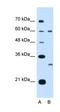 Tetraspanin 32 antibody, orb325285, Biorbyt, Western Blot image 