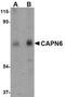 Calpain 6 antibody, NBP1-76937, Novus Biologicals, Western Blot image 