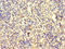 Signal Recognition Particle 19 antibody, LS-C396765, Lifespan Biosciences, Immunohistochemistry paraffin image 