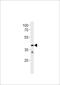 Trace Amine Associated Receptor 2 (Gene/Pseudogene) antibody, A13965-1, Boster Biological Technology, Western Blot image 