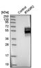 Interferon Gamma Receptor 2 antibody, NBP1-90223, Novus Biologicals, Western Blot image 