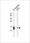 Hemoglobin subunit beta-2 antibody, PA5-72656, Invitrogen Antibodies, Western Blot image 