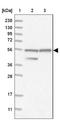 HGNAT antibody, NBP1-81990, Novus Biologicals, Western Blot image 