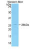 Interleukin 1 Receptor Associated Kinase 3 antibody, LS-C294802, Lifespan Biosciences, Western Blot image 