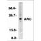 Nucleolar Protein 3 antibody, LS-C324, Lifespan Biosciences, Western Blot image 
