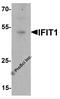 Interferon Induced Protein With Tetratricopeptide Repeats 1 antibody, 7757, ProSci Inc, Western Blot image 