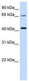 Glutaminyl-Peptide Cyclotransferase Like antibody, TA342033, Origene, Western Blot image 