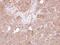 AHSA1 antibody, PA5-27672, Invitrogen Antibodies, Immunohistochemistry paraffin image 