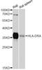 Major Histocompatibility Complex, Class II, DR Alpha antibody, LS-C747133, Lifespan Biosciences, Western Blot image 