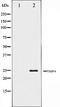 TIMP Metallopeptidase Inhibitor 4 antibody, orb106543, Biorbyt, Western Blot image 