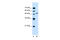 Nuclear Receptor Subfamily 1 Group I Member 2 antibody, 29-121, ProSci, Western Blot image 