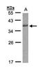 Cell Division Cycle 34 antibody, NBP1-32153, Novus Biologicals, Western Blot image 