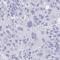 PR/SET Domain 7 antibody, HPA059944, Atlas Antibodies, Immunohistochemistry paraffin image 