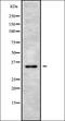 Pim-2 Proto-Oncogene, Serine/Threonine Kinase antibody, orb338683, Biorbyt, Western Blot image 