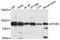 Eukaryotic Translation Initiation Factor 2B Subunit Epsilon antibody, A10263, ABclonal Technology, Western Blot image 