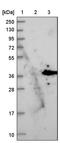 Protein Phosphatase 1 Regulatory Subunit 3B antibody, PA5-55965, Invitrogen Antibodies, Western Blot image 