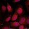 Myocyte Enhancer Factor 2A antibody, orb14454, Biorbyt, Immunofluorescence image 