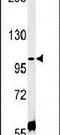 Coiled-Coil Domain Containing 146 antibody, PA5-25376, Invitrogen Antibodies, Western Blot image 