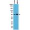 SMAD Family Member 4 antibody, M00074-1, Boster Biological Technology, Western Blot image 