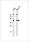 Actin Related Protein 2 antibody, 62-307, ProSci, Western Blot image 
