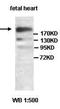 Sortilin Related Receptor 1 antibody, orb77607, Biorbyt, Western Blot image 