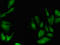 Pim-1 Proto-Oncogene, Serine/Threonine Kinase antibody, LS-C679043, Lifespan Biosciences, Immunofluorescence image 